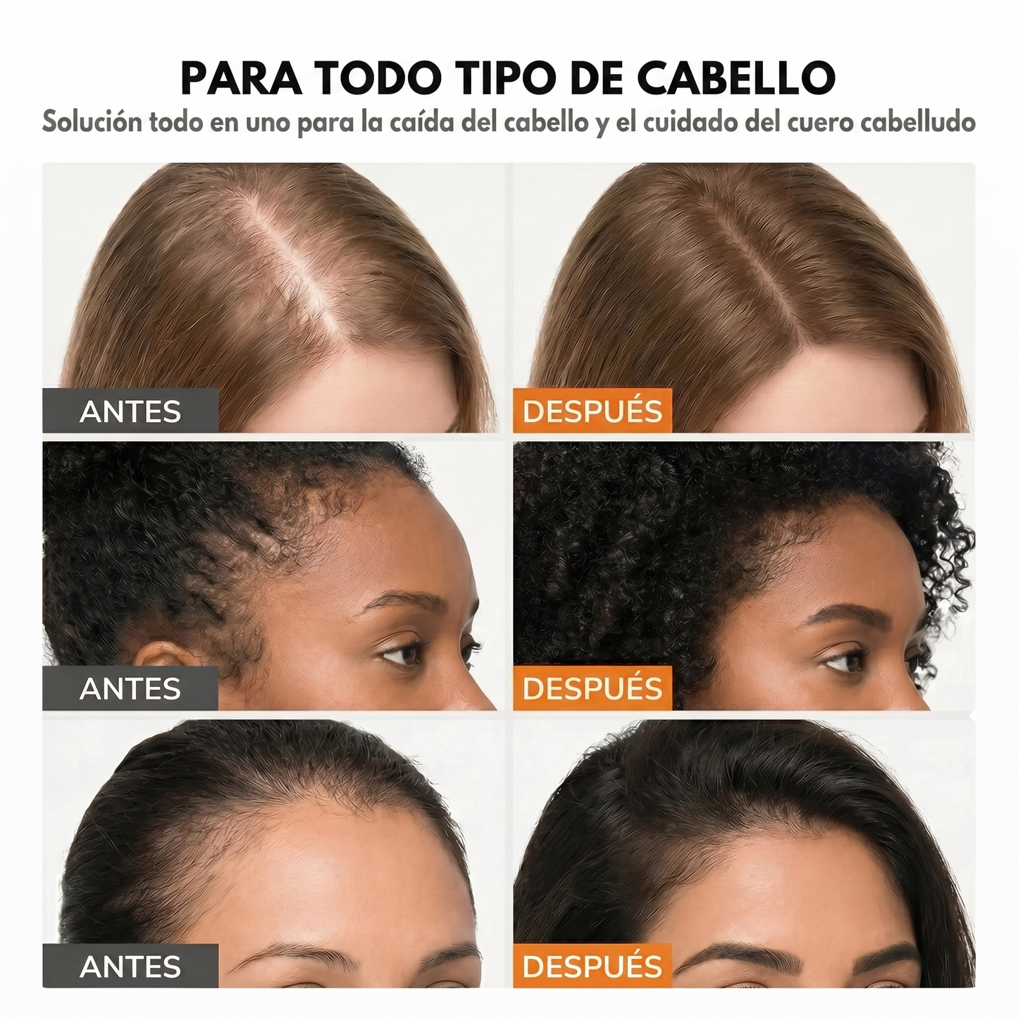 El sérum para el crecimiento del cabello #1 de Corea