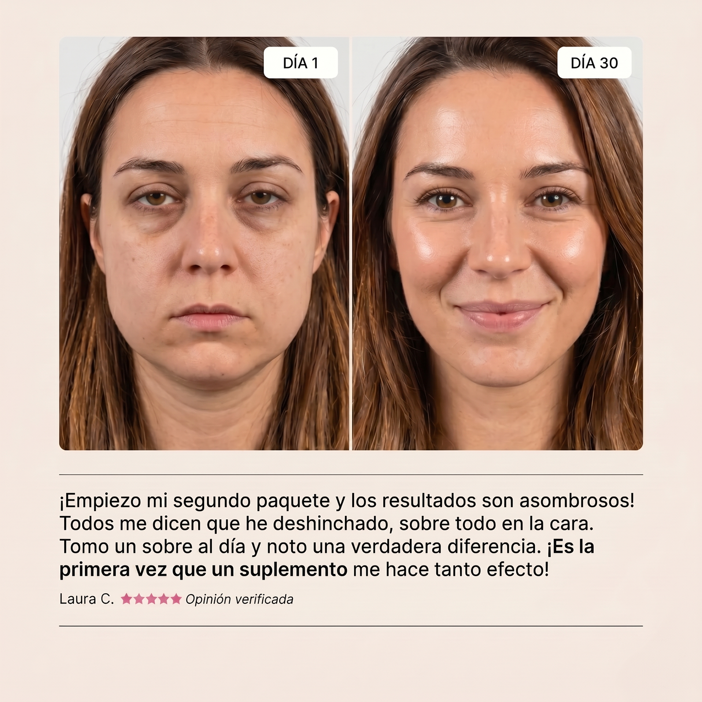 Elevare Cortisol Manager